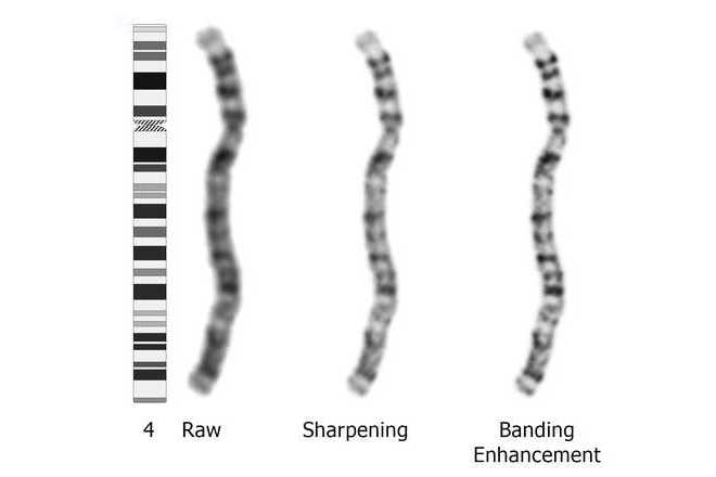 Example of enhancements to the appearance of chromosome 4, from the left: raw image, sharpened image, enhanced banding image