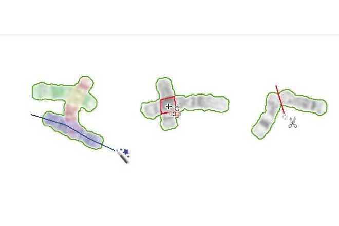 Semi-automated tools for chromosome separation image