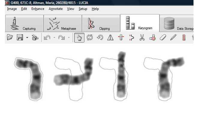 Chromosome adjustments image
